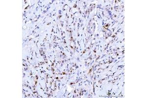 IHC analysis of Cdk2 using anti-Cdk2 antibody (ABIN7602522). (CDK2 anticorps  (AA 81-298))