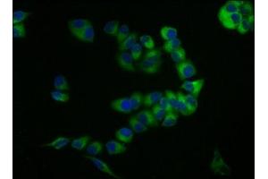 Immunofluorescence staining of PC-3 cells with ABIN7147167 at 1:133, counter-stained with DAPI.