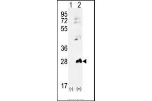 Western blot analysis of AK1 (arrow) using rabbit polyclonal AK1 Antibody (S45) (ABIN392794 and ABIN2842231). (Adenylate Kinase 1 anticorps  (N-Term))