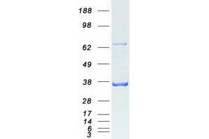 Validation with Western Blot