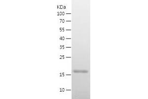 Western Blotting (WB) image for Myoglobin (MB) (AA 2-154) protein (His tag) (ABIN7124051)