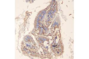 IHC analysis of TRAF6 using anti-TRAF6 antibody (ABIN7600026). (TRAF6 anticorps  (AA 14-512))