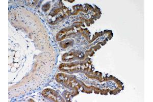 IHC analysis of GALNS using anti-GALNS antibody .
