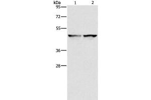 Western Blot analysis of 231 and hela cell using IDH1 Polyclonal Antibody at dilution of 1:550 (IDH1 anticorps)