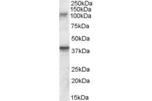 Image no. 1 for anti-Glutamate Receptor, Ionotropic, Kainate 3 (GRIK3) (Internal Region) antibody (ABIN375008) (GRIK3 anticorps  (Internal Region))