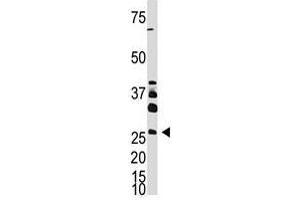 Image no. 1 for anti-Dickkopf Homolog 4 (Xenopus Laevis) (DKK4) (AA 7-36), (N-Term) antibody (ABIN357073) (DKK4 anticorps  (N-Term))