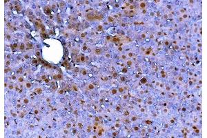 IHC analysis of FADD using anti-FADD antibody (ABIN7602804).