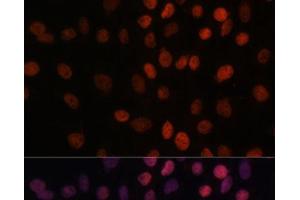 Immunofluorescence analysis of C6 cells using ARID1B Polyclonal Antibody at dilution of 1:100.
