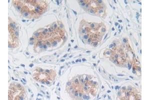 DAB staining on IHC-P; Samples: Human Stomach Tissue (MMP3 anticorps  (AA 289-452))