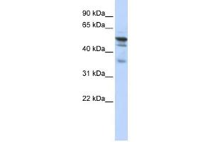 NMT1 antibody used at 1 ug/ml to detect target protein.
