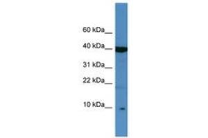 Image no. 1 for anti-serine Peptidase Inhibitor, Kazal Type 6 (SPINK6) (C-Term) antibody (ABIN6746431)