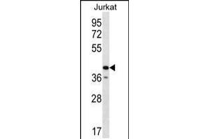 Western blot analysis in Jurkat cell line lysates (35ug/lane). (GORASP2 anticorps  (AA 185-214))