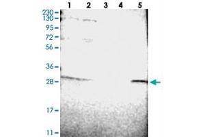 Western blot analysis of Lane 1: RT-4, Lane 2: U-251 MG, Lane 3: Human Plasma, Lane 4: Liver, Lane 5: Tonsil with ERGIC1 polyclonal antibody  at 1:250-1:500 dilution. (ERGIC1 anticorps)