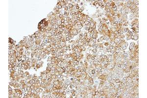 IHC-P Image Immunohistochemical analysis of paraffin-embedded TOV-112D xenograft, using JAM-B, antibody at 1:100 dilution.