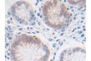 Detection of FGFRL1 in Human Stomach Tissue using Polyclonal Antibody to Fibroblast Growth Factor Receptor Like Protein 1 (FGFRL1)