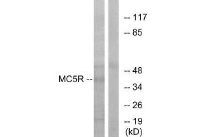 Western Blotting (WB) image for anti-Melanocortin 5 Receptor (MC5R) (C-Term) antibody (ABIN1853066) (MC5 Receptor anticorps  (C-Term))