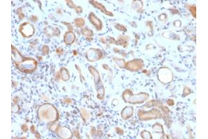 Formalin-fixed, paraffin-embedded human Kidney stained with ARF1 Mouse Monoclonal Antibody (ARF1/2117).