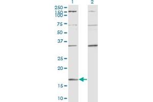 Western Blot analysis of RARRES2 expression in transfected 293T cell line by RARRES2 monoclonal antibody (M02), clone 3E3. (Chemerin anticorps  (AA 17-163))