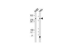 All lanes : Anti-TRR Antibody (C-term) at 1:2000 dilution Lane 1: K562 whole cell lysates Lane 2: Hela whole cell lysates Lysates/proteins at 20 μg per lane. (TRRAP anticorps  (C-Term))