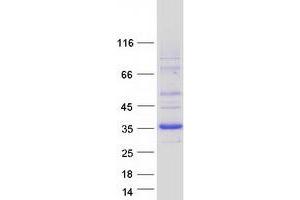 Validation with Western Blot