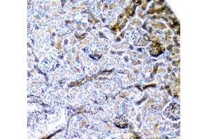 IHC analysis of CD2AP using anti-CD2AP antibody (ABIN6719544). (CD2AP anticorps  (AA 253-337))