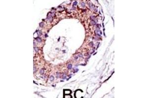 anti-Ubiquitination Factor E4A (UBE4A) (AA 1037-1067), (C-Term) antibody