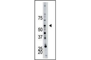 Image no. 1 for anti-6-phosphofructo-2-Kinase/fructose-2,6-Biphosphatase 4 (PFKFB4) (AA 274-303) antibody (ABIN360670) (PFKFB4 anticorps  (AA 274-303))
