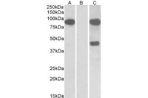 HEK293 lysate (10ug protein in RIPA buffer) overexpressing Human Numbl with C-terminal MYC tag probed with ABIN5539874 (1ug/ml) in Lane A and probed with anti-MYC Tag (1/1000) in lane C.