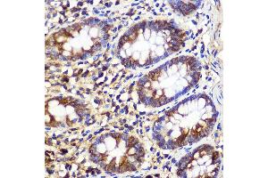 Immunohistochemistry of paraffin-embedded Human colon using  Rabbit pAb (ABIN6133192, ABIN6137243, ABIN6137244 and ABIN6223255) at dilution of 1:100 (40x lens).