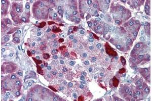Pancreas, Human: Formalin-Fixed, Paraffin-Embedded (FFPE) (LRRN4 anticorps  (N-Term))