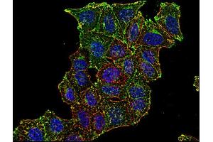 Immunocytochemistry staining of CD71 in human HeLa cell line using anti-CD71 (MEM-75, green).