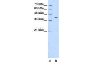 Western Blotting (WB) image for anti-Pregnancy Specific beta-1-Glycoprotein 6 (PSG6) antibody (ABIN2462492)