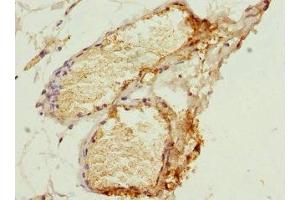 Immunohistochemistry of paraffin-embedded human plasma tissue using ABIN7155026 at dilution of 1:100 (SERPIND1 anticorps  (AA 20-290))