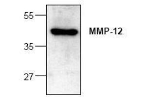 Image no. 1 for anti-Matrix Metallopeptidase 12 (Macrophage Elastase) (MMP12) antibody (ABIN127325) (MMP12 anticorps)
