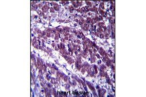 OGDH Antibody (C-term) (ABIN657365 and ABIN2846412) immunohistochemistry analysis in formalin fixed and paraffin embedded human heart tissue followed by peroxidase conjugation of the secondary antibody and DAB staining.
