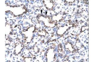 Image no. 1 for anti-Endoglin (ENG) (AA 61-110) antibody (ABIN202837)