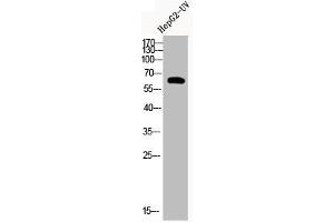 Western Blot analysis of HEPG2-UV cells using Acetyl-Cortactin (K235) Polyclonal Antibody (Cortactin anticorps  (acLys235))