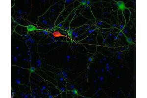 Indirect immunostaining of methanol fixed rat hippocampus neurons with anti-calretinin (dilution 1 : 500; red) and mouse anti-MAP 2 (, dilution 1 : 1000; green).