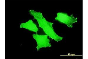 Immunofluorescence of monoclonal antibody to MPP1 on HeLa cell.