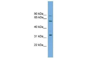 Western Blot showing PTDSS2 antibody used at a concentration of 1-2 ug/ml to detect its target protein. (PTDSS2 anticorps  (Middle Region))