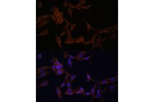 Immunofluorescence analysis of HeLa cells using SERPINB9 antibody (ABIN6130941, ABIN6147596, ABIN6147597 and ABIN6222020) at dilution of 1:100.