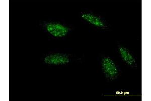 Immunofluorescence of monoclonal antibody to TWIST1 on HeLa cell.