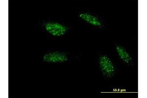 Immunofluorescence of monoclonal antibody to TWIST1 on HeLa cell. (TWIST1 anticorps  (AA 100-202))