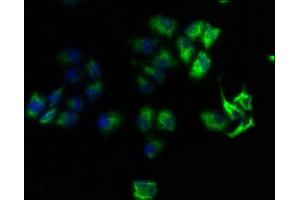 Immunofluorescence staining of Hela cells with ABIN7167999 at 1:100, counter-stained with DAPI. (ROCK1 anticorps  (AA 405-668))
