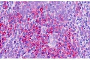 Human Tonsil: Formalin-Fixed, Paraffin-Embedded (FFPE)