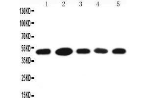 Anti-HSC70 Interacting Protein HIP antibody, Western blotting Lane 1: A431 Cell Lysate Lane 2: HELA Cell Lysate Lane 3: 293T Cell Lysate Lane 4: JURKAT Cell Lysate Lane 5: MCF-7 Cell Lysate (HSC70 Interacting Protein HIP anticorps  (N-Term))