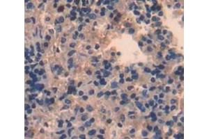 Used in DAB staining on fromalin fixed paraffin- embedded Kidney tissue