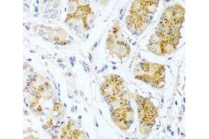 Immunohistochemistry of paraffin-embedded Human stomach using Endothelin 1 Polyclonal Antibody at dilution of 1:100 (40x lens). (Endothelin 1 anticorps)