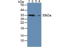 Western blot analysis of (1) Mouse Kidney Tissue, (2) Mouse Liver Tissue, (3) Rat Kidney Tissue and (4) Human 293T Cells. (CBR1 anticorps  (AA 66-271))