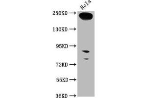 Western Blot Positive WB detected in: Hela whole cell lysate All lanes: RTTN antibody at 1:1000 Secondary Goat polyclonal to rabbit IgG at 1/50000 dilution Predicted band size: 249, 68, 246, 99 kDa Observed band size: 249 kDa (Rotatin (RTTN) (AA 1509-1603) anticorps)
